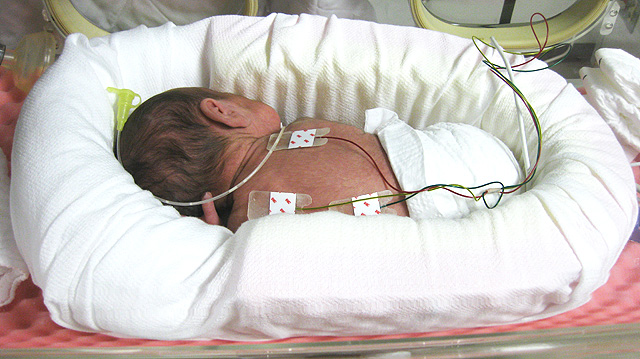 NICU・新生児センター（小児医療センター）｜宮崎県立宮崎病院