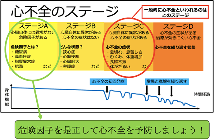 心不全のステージ